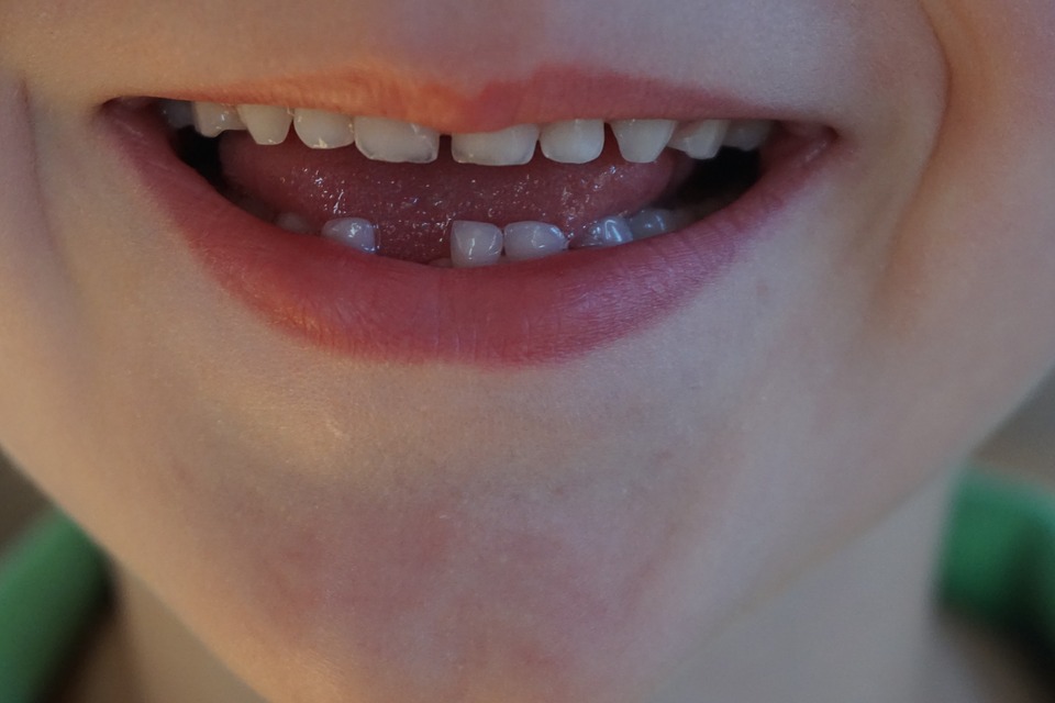 mléčné zuby